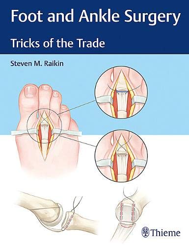 Algopix Similar Product 10 - Foot and Ankle Surgery Tricks of the