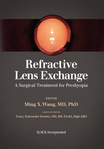 Algopix Similar Product 17 - Refractive Lens Exchange A Surgical