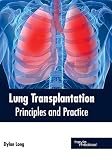 Algopix Similar Product 2 - Lung Transplantation Principles and