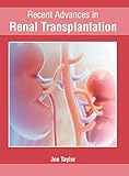 Algopix Similar Product 5 - Recent Advances in Renal Transplantation