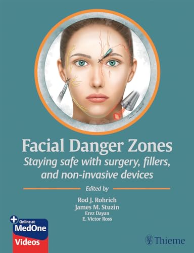 Algopix Similar Product 13 - Facial Danger Zones Staying safe with
