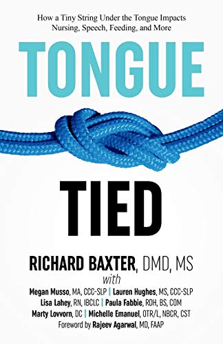 Algopix Similar Product 4 - TongueTied How a Tiny String Under