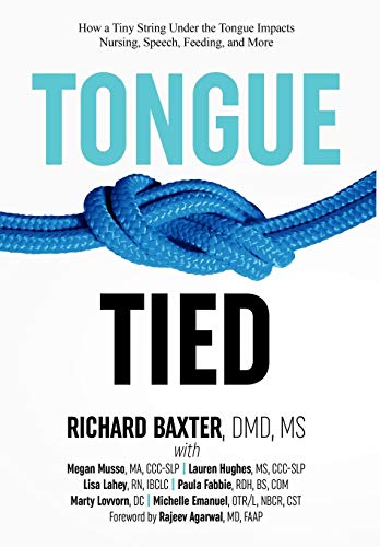 Algopix Similar Product 17 - TongueTied How a Tiny String Under