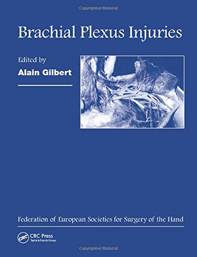 Algopix Similar Product 17 - Brachial Plexus Injuries