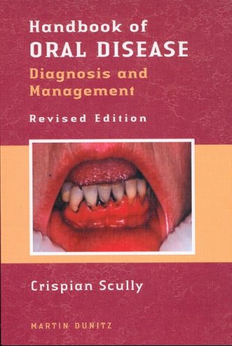 Algopix Similar Product 4 - Handbook of Oral Diseases