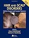 Algopix Similar Product 10 - Hair and Scalp Disorders Medical