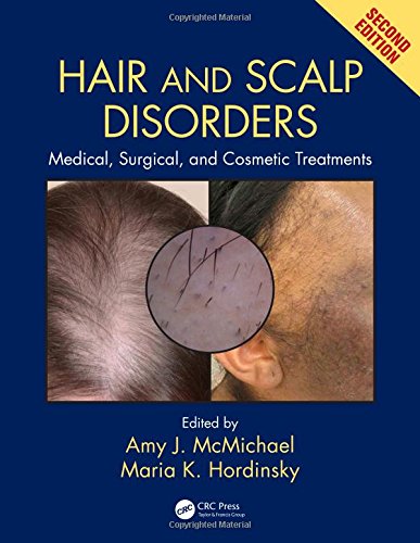 Algopix Similar Product 3 - Hair and Scalp Disorders Medical