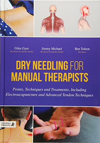 Algopix Similar Product 19 - Dry Needling for Manual Therapists
