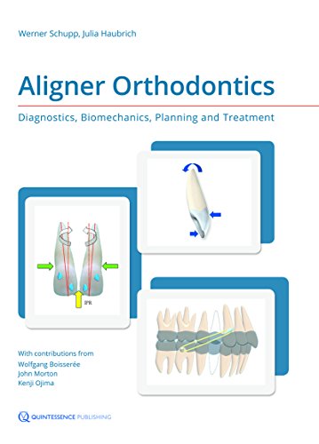 Algopix Similar Product 3 - Aligner Orthodontics Diagnostics