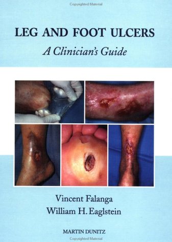 Algopix Similar Product 13 - Leg and Foot Ulcers: A Clinician's Guide