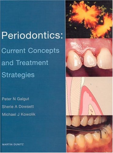 Algopix Similar Product 13 - Periodontics Current Concepts and