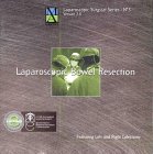 Algopix Similar Product 19 - Laparoscopic Bowel Resection Featuring