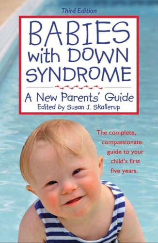 Algopix Similar Product 18 - Babies With Down Syndrome A New