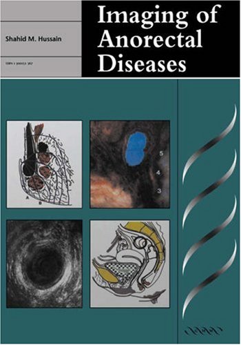 Algopix Similar Product 2 - Imaging of Anorectal Diseases