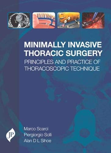 Algopix Similar Product 4 - Minimally Invasive Thoracic Surgery