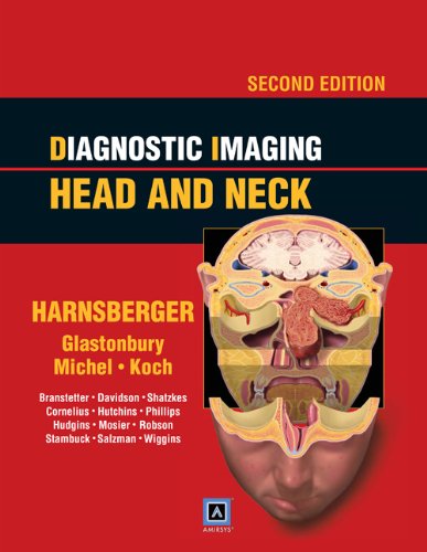 Algopix Similar Product 1 - Diagnostic Imaging Head and Neck