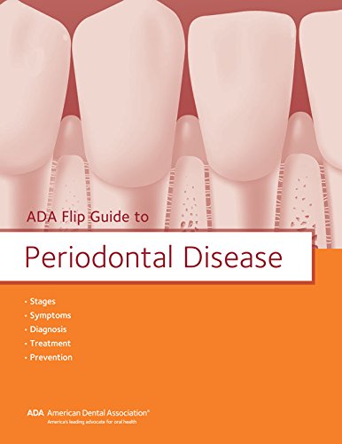 Algopix Similar Product 9 - ADA Flip Guide to Periodontal Disease