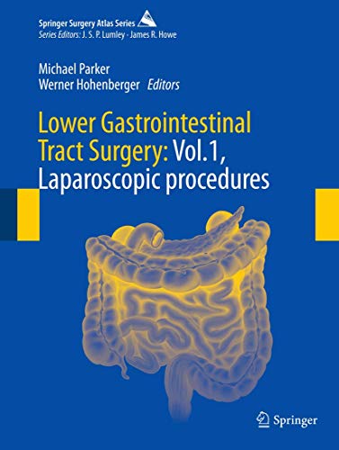 Algopix Similar Product 19 - Lower Gastrointestinal Tract Surgery