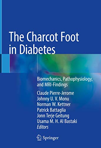 Algopix Similar Product 16 - The Charcot Foot in Diabetes