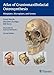 Algopix Similar Product 11 - Atlas of Craniomaxillofacial