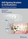 Algopix Similar Product 19 - Selfligating Brackets in Orthodontics