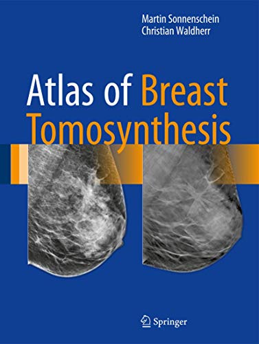 Algopix Similar Product 7 - Atlas of Breast Tomosynthesis Imaging