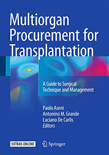 Algopix Similar Product 20 - Multiorgan Procurement for