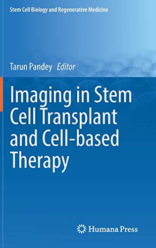 Algopix Similar Product 1 - Imaging in Stem Cell Transplant and