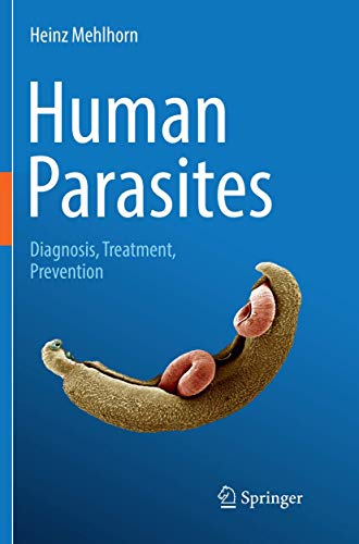 Algopix Similar Product 5 - Human Parasites Diagnosis Treatment