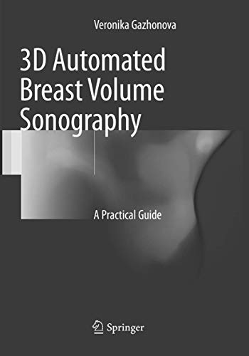 Algopix Similar Product 3 - 3D Automated Breast Volume Sonography