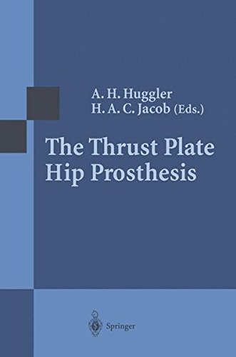 Algopix Similar Product 4 - The Thrust Plate Hip Prosthesis