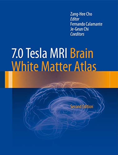 Algopix Similar Product 1 - 7.0 Tesla MRI Brain White Matter Atlas