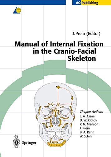 Algopix Similar Product 3 - Manual of Internal Fixation in the