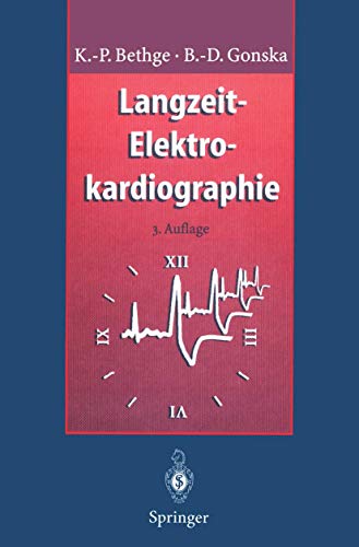 Algopix Similar Product 5 - LangzeitElektrokardiographie
