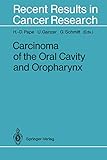 Algopix Similar Product 2 - Carcinoma of the Oral Cavity and
