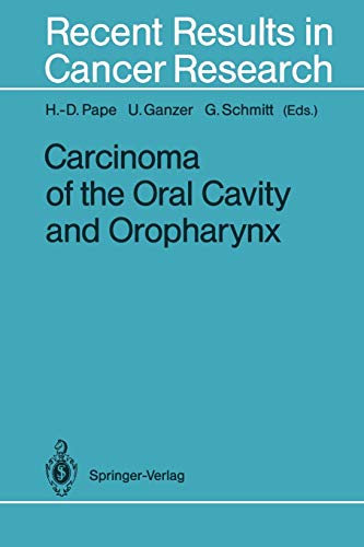 Algopix Similar Product 14 - Carcinoma of the Oral Cavity and