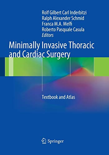 Algopix Similar Product 5 - Minimally Invasive Thoracic and Cardiac