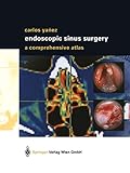 Algopix Similar Product 5 - Endoscopic Sinus Surgery A