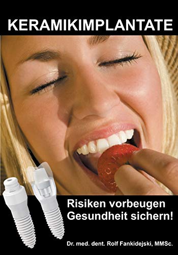 Algopix Similar Product 20 - Keramikimplantate Risiken vorbeugen