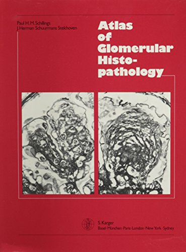 Algopix Similar Product 15 - Atlas of Glomerular Histopathology