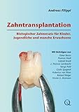 Algopix Similar Product 12 - Zahntransplantation Biologischer