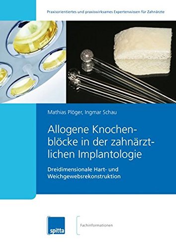 Algopix Similar Product 15 - Allogene Knochenblcke in der