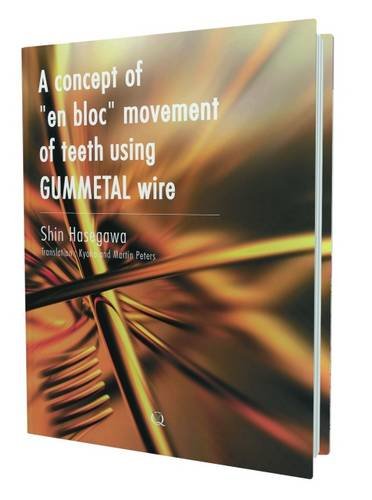 Algopix Similar Product 5 - A Concept of En Bloc Movement of Teeth
