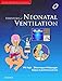 Algopix Similar Product 11 - Essentials of Neonatal Ventilation 1st