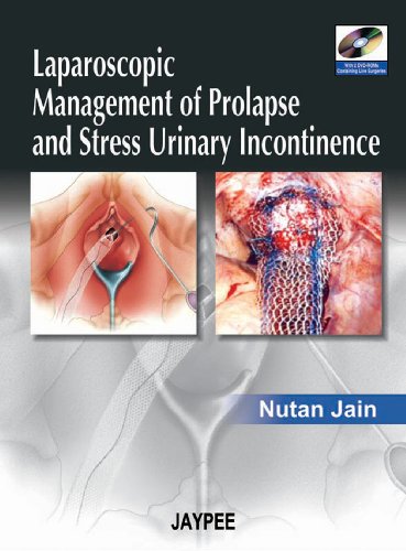 Algopix Similar Product 8 - Laparoscopic Management of Prolapse and