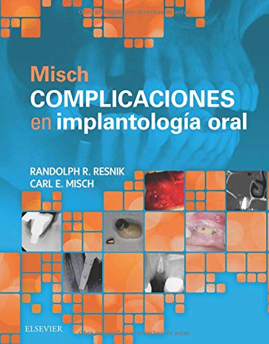 Algopix Similar Product 14 - MISCH COMPLICACIONES EN IMPLANTOLOGIA