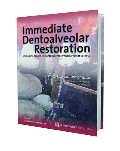 Algopix Similar Product 11 - Immediate Dentoalveolar Restoration