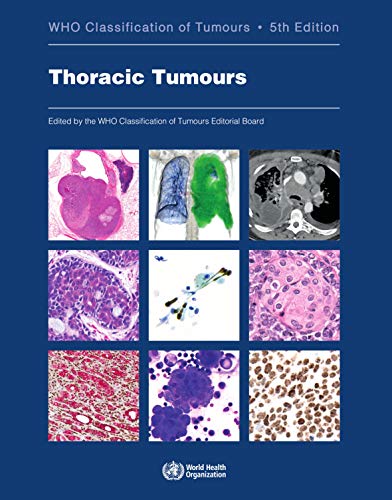Algopix Similar Product 11 - Thoracic Tumours WHO Classification of
