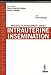 Algopix Similar Product 6 - Intrauterine Insemination Infertility