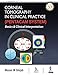 Algopix Similar Product 9 - Corneal Tomography in Clinical Practice